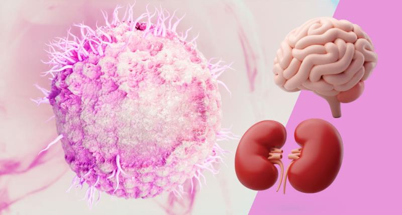 Herpes zoster encephalitis in two patients with kidney disease: Diagnostic and therapeutic challenges
