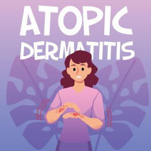 AAD 2025: Key insights on abrocitinib in atopic dermatitis management