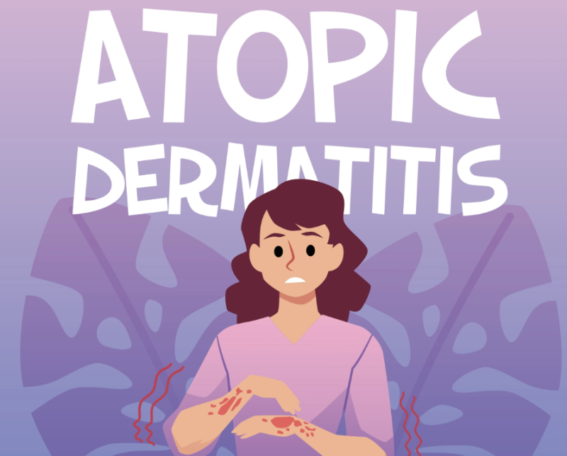 AAD 2025: Key insights on abrocitinib in atopic dermatitis management