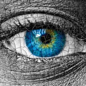 Multidisciplinary effort facilitates care for ICI-related Sjogren's syndrome