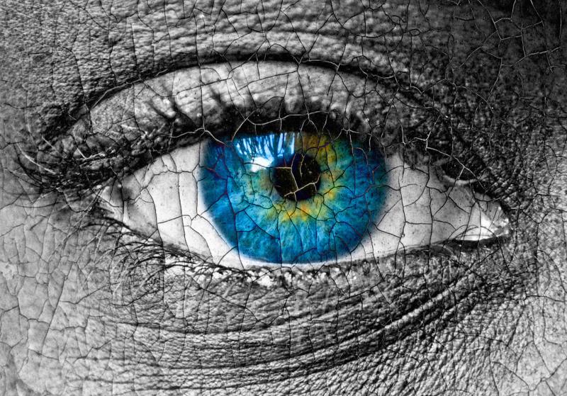 Multidisciplinary effort facilitates care for ICI-related Sjogren's syndrome