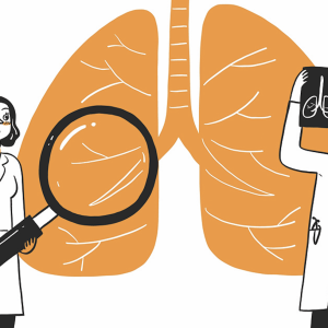 Lung nodule surveillance programme helps detect early-stage lung cancer