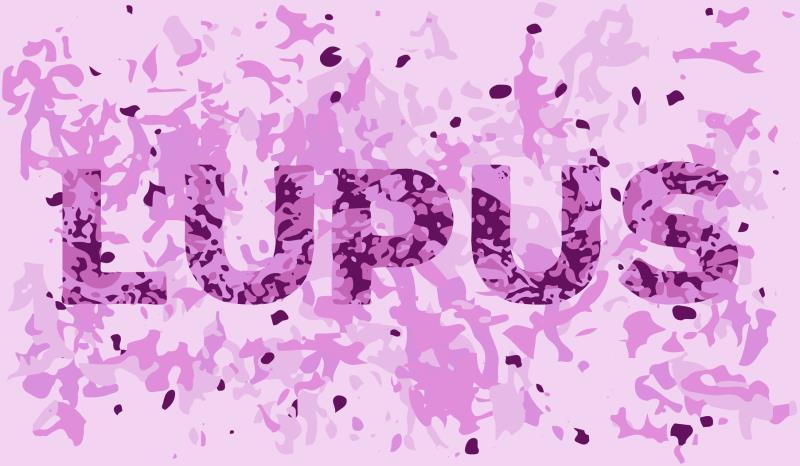 Vitamin D implicated in systemic lupus erythematosus