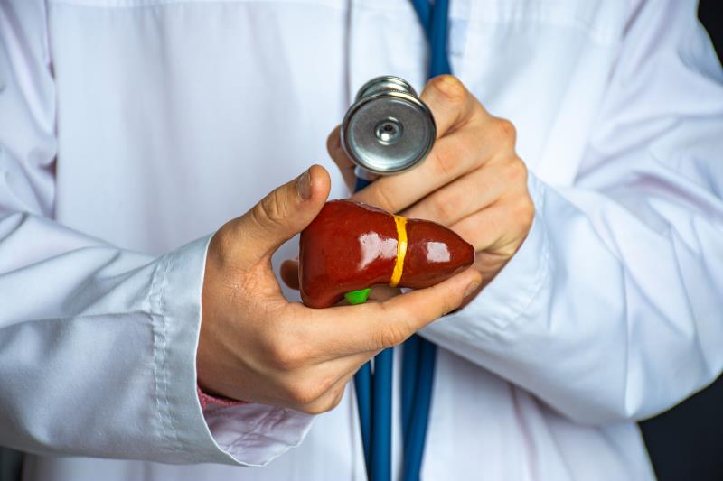 GCSF plus prednisolone improves survival in severe alcohol-associated hepatitis