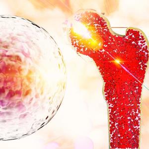 Momelotinib simplifies treatment for myelofibrosis with anaemia
