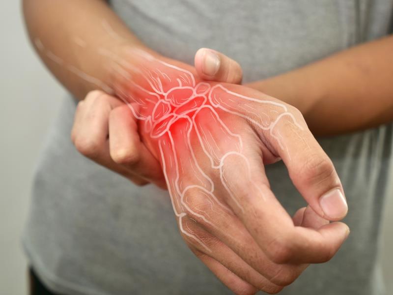 <p style="margin: 0cm;"><span>In patients with early <a href="https://www.mims.com/hongkong/disease/rheumatoid-arthritis/dise