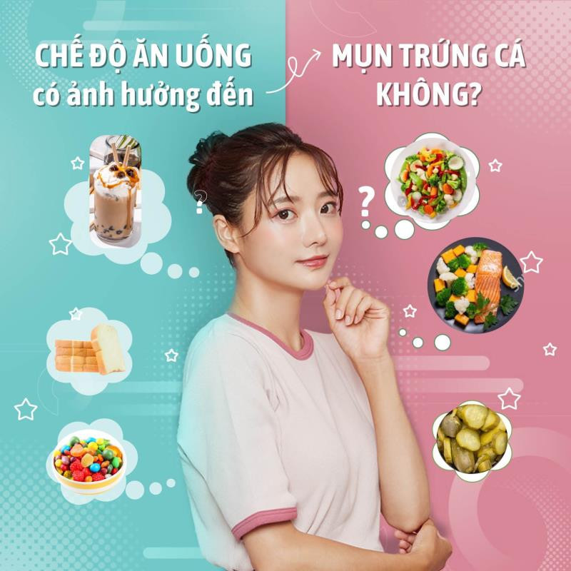 [Infographic] Cải thiện mụn bằng chế độ ăn? – Đúng nhưng chưa đủ
