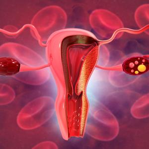 Raludotatug deruxtecan shows efficacy signal in platinum-sensitive ovarian cancer