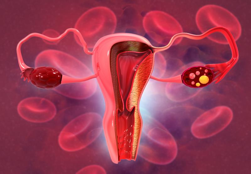 Raludotatug deruxtecan shows efficacy signal in platinum-sensitive ovarian cancer