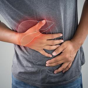 Efruxifermin misses mark in MASH-related compensated cirrhosis