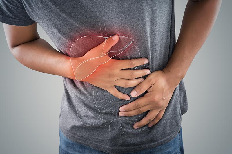 Efruxifermin misses mark in MASH-related compensated cirrhosis