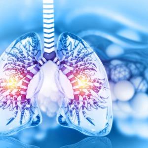Personalizing upfront treatment options for advanced EGFRm
NSCLC