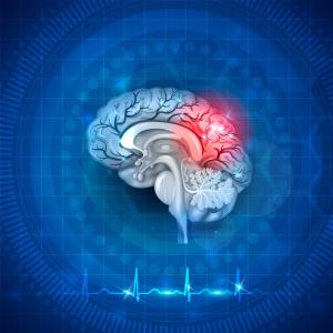 Residual recurrence risk high after AF-related stroke