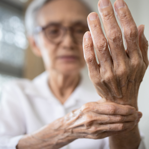 IBD tied to increased risk of rheumatoid arthritis