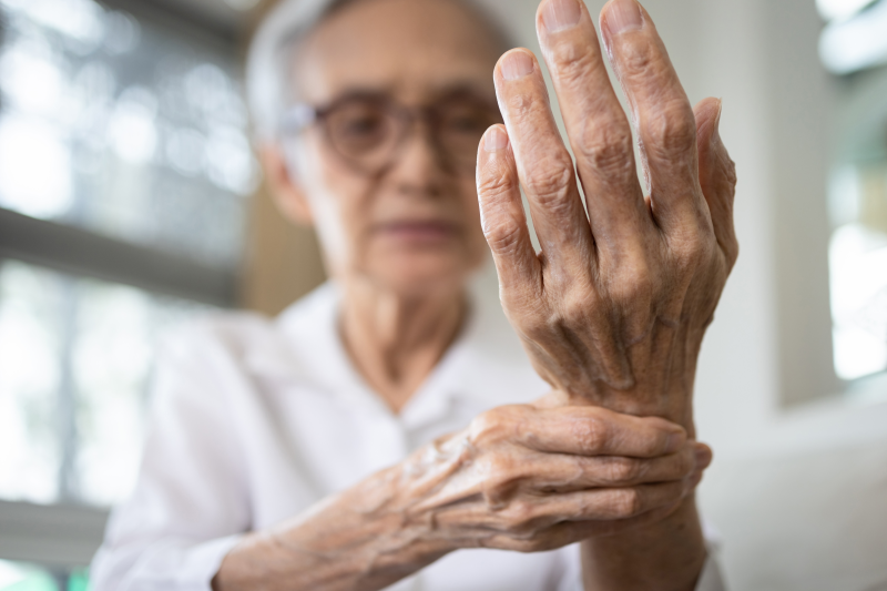 IBD tied to increased risk of rheumatoid arthritis