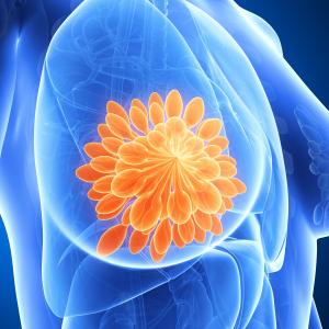 No benefit to adding adjuvant chemo to hormonotherapy in high-risk breast cancer