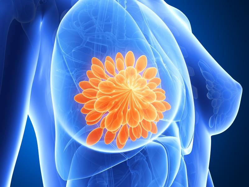 No benefit to adding adjuvant chemo to hormonotherapy in high-risk breast cancer