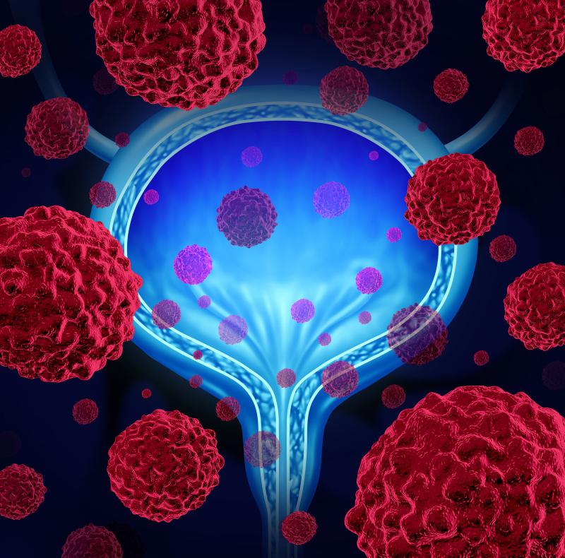 Gemcitabine for IR-NMIBC tied to more recurrence vs BCG