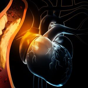 Inclisiran confers LDL–C-lowering benefit in adolescents with HoFH