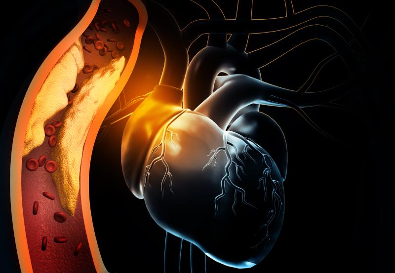 Inclisiran confers LDL–C-lowering benefit in adolescents with HoFH