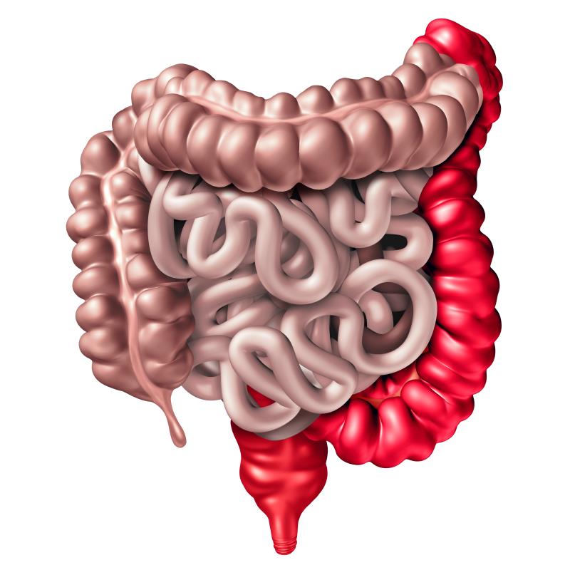 Plant-based fasting-mimicking diet does not boost medication response in UC