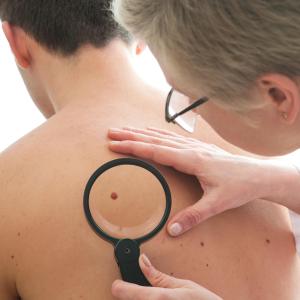 Multiple skin cancers can occur in treated patients, says study