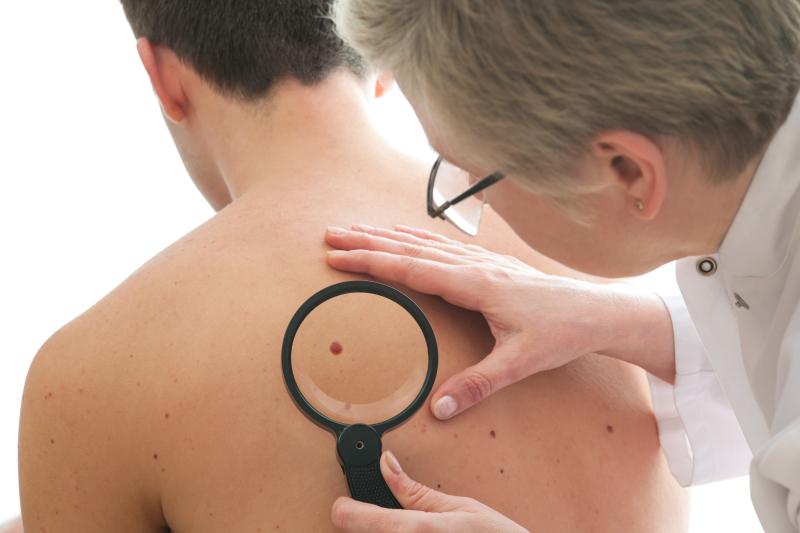 Multiple skin cancers can occur in treated patients, says study