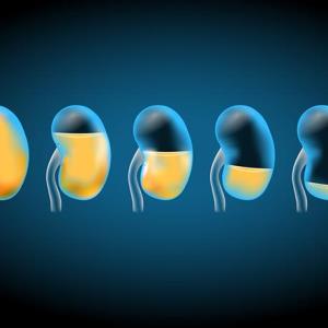 Targeted-release budesonide formulation makes good in IgAN regardless of baseline eGFR