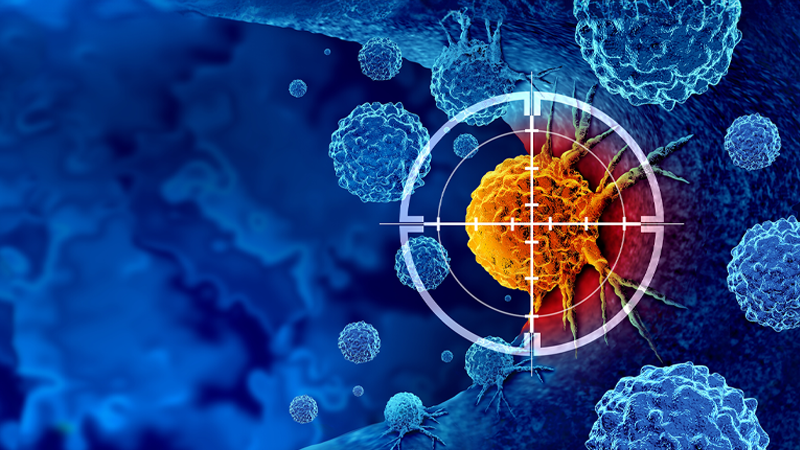 Professor Roger Ngan, a specialist in clinical
oncology, provides insights into the treatment landscape of melanoma and his