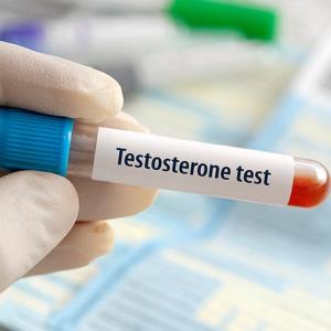 Does testosterone level predict metastasis-free survival in nmCRPC?