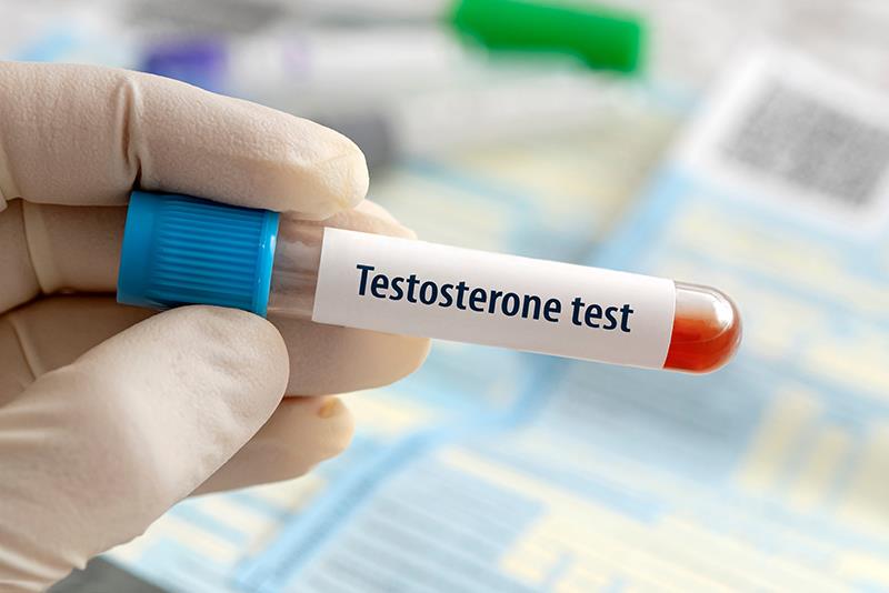 Does testosterone level predict metastasis-free survival in nmCRPC?