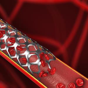 FUTURE-III trial reinforces potential of thinner-strut BRS for CAD