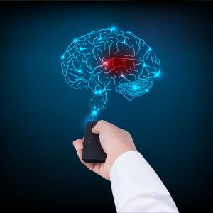 Stroke risk high after transient ischaemic attack