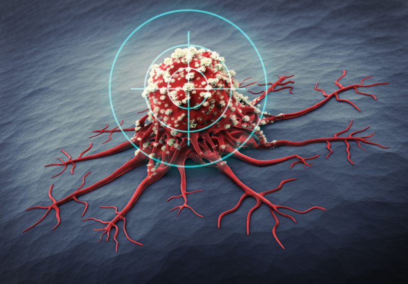 Pembrolizumab plus chemo efficacious in advanced PSCC