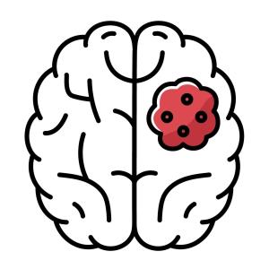 Tumour vaccines show potential for glioma treatment
