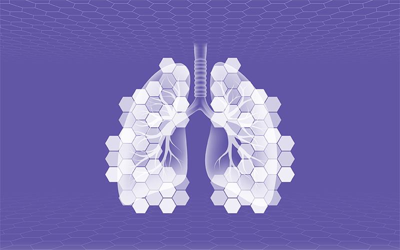 Updating Interstitial Lung Disease from the American Thoracic Society 2025