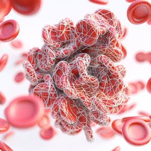 Apixaban recommended for thromboprophylaxis in ovarian cancer patients on chemo