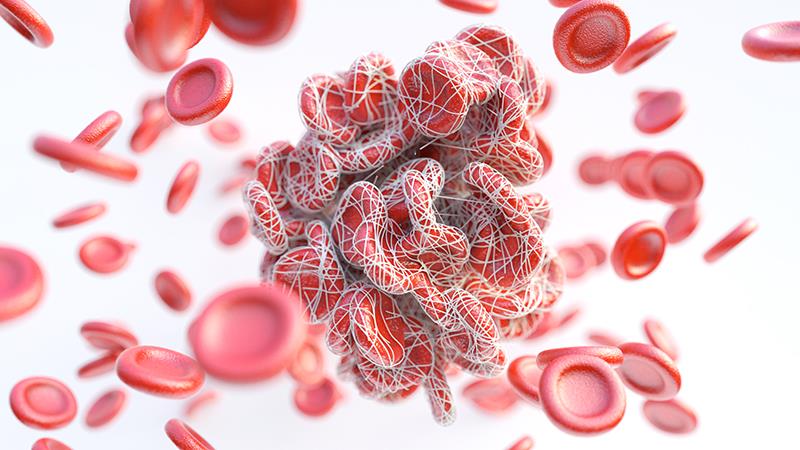 Data presented at ESMO Gyn 2025 support apixaban as a <a href="https://www.mims.com/singapore/disease/venous-thromboembolism-