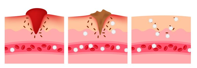 Wound healing is improved in wounds that are inflicted in the daytime and are free of bacteria