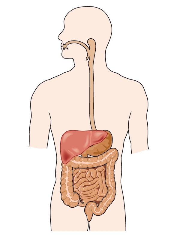 Barrett's Esophagus