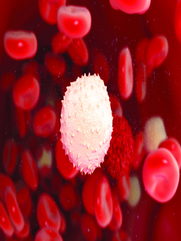 Bệnh bạch cầu mạn dòng lympho