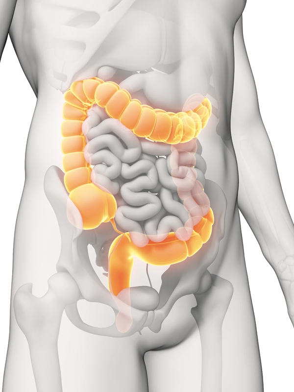 Diarrhea in Adults - Chronic