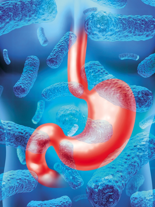 Gastroenteritis - Bacterial