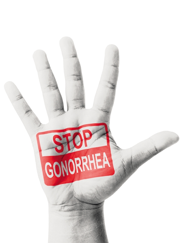 Gonorrhea - Uncomplicated Anogenital Infection