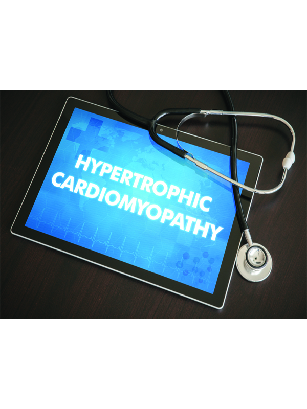 Hypertrophic Cardiomyopathy