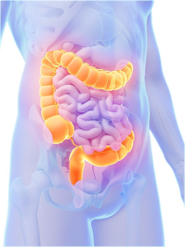 Irritable Bowel Syndrome