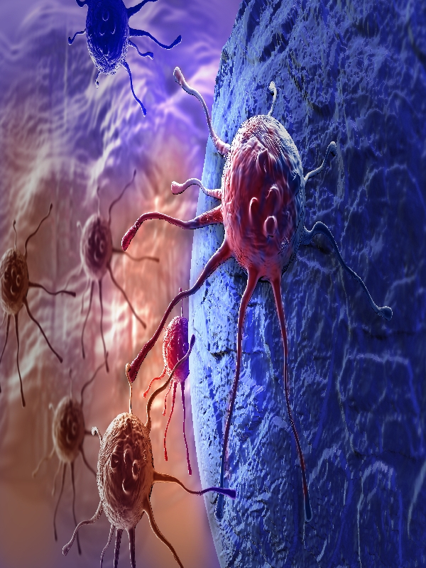 Neuroendocrine Tumors