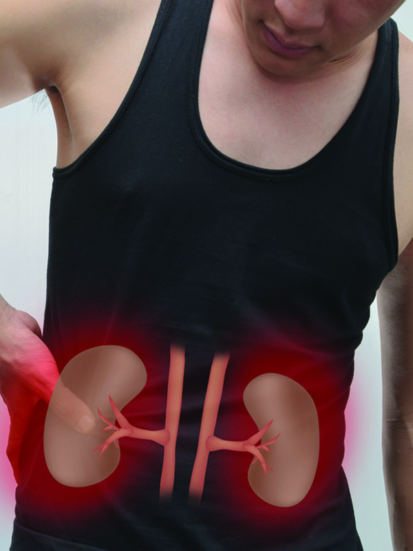 Renal Cancer