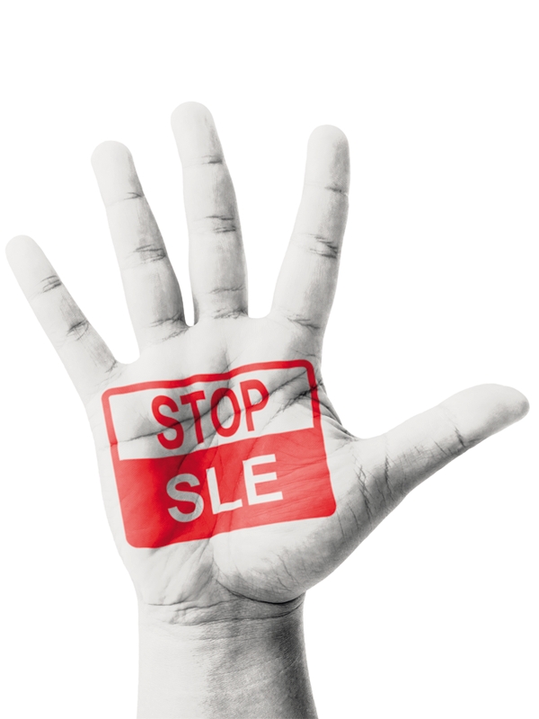 Lupus ban đỏ hệ thống