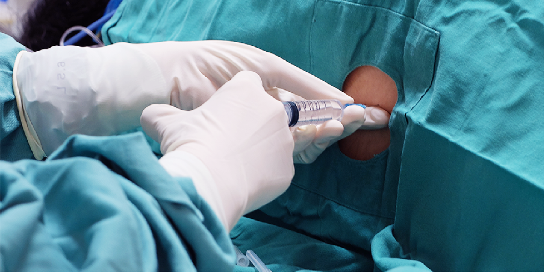 Meningitis - Acute, Bacterial_Diagnostics 1
